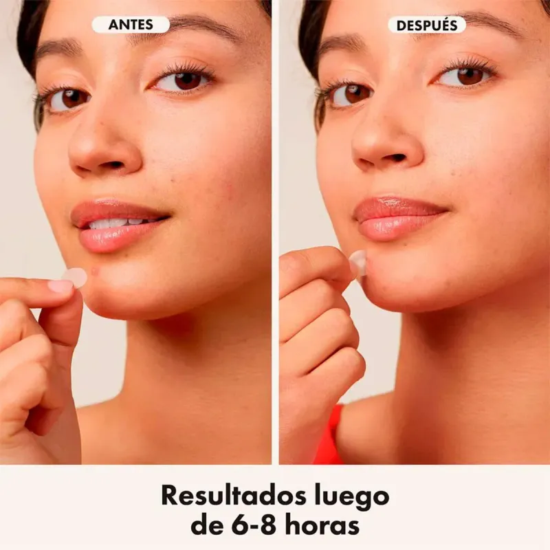 Mighty Patch Invisible Parches para Acne Hero 24u