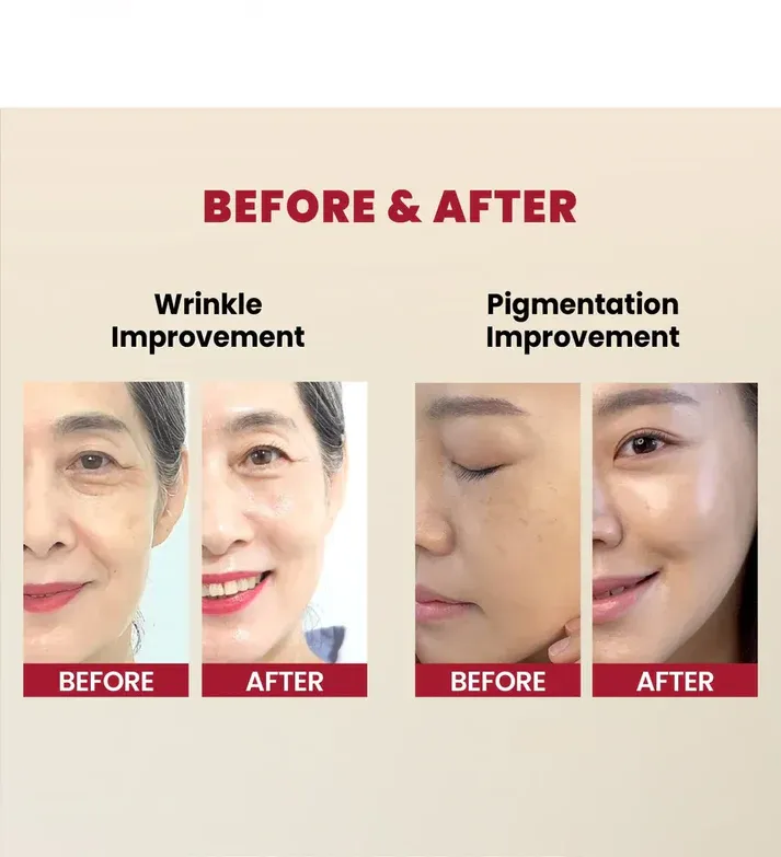 KSECRET - SEOUL 1988 Serum: Retinal Liposome 2% + Black Ginseng