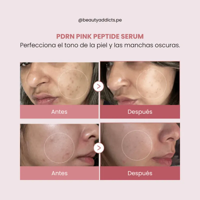 MEDICUBE - PDRN Pink Peptide Serum