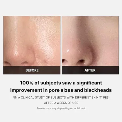 MEDICUBE - Zero Pore Pad 2.0 70 pads