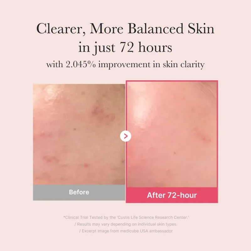 MEDICUBE - TXA Niacinamide 15 Serum