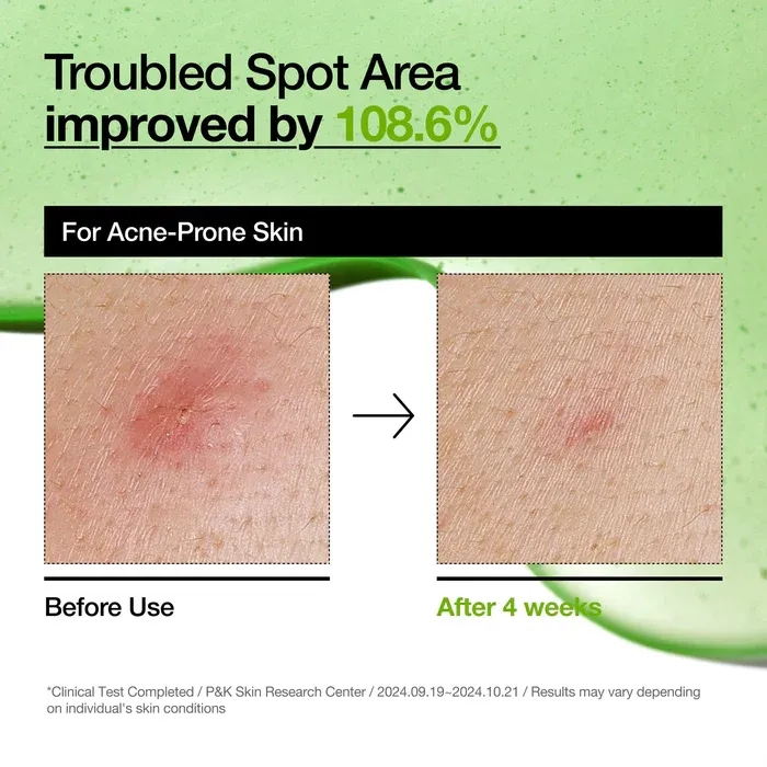 ANUA- Azelaic Acid 10% Hyaluron