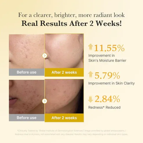 MEDICUBE - Kojic Acid Turmeric Niacinamide Serum