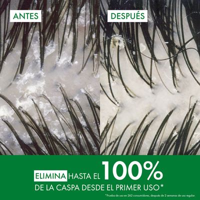 Vichy Dercos Anticaspa DS