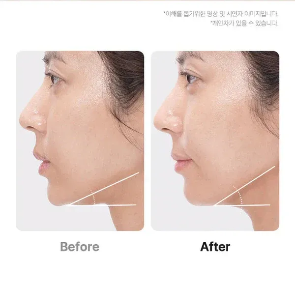 MEDICUBE – Age-R Booster Pro Mini Plus Pink