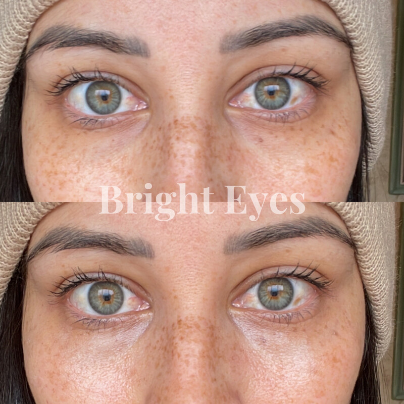 Eye Love Bright Eyes