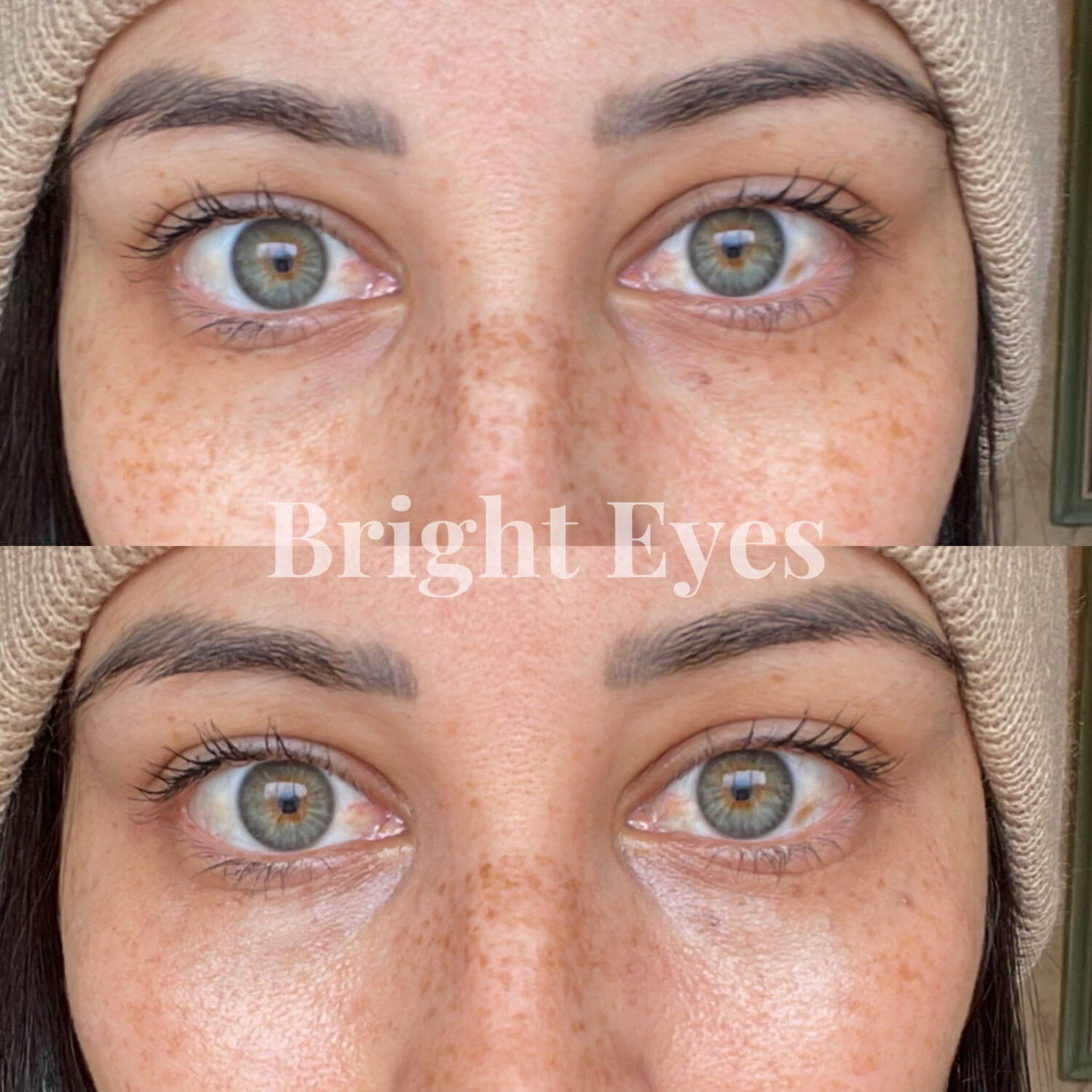 Eye Love Bright Eyes