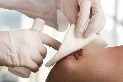 Wound Care Dresssing