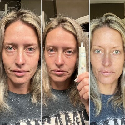 ageLOC Ideal Eyes Eye Cream