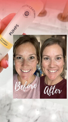 Vitamin C &amp; Collagen Pump