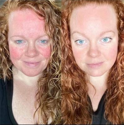 Retinol + Future Serum Bundle