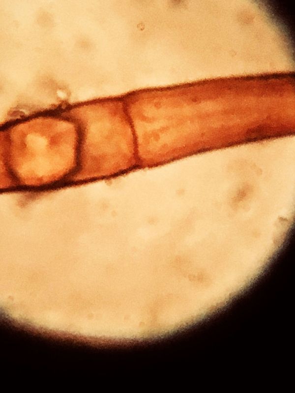 Mycélium de morille sur gélose G1