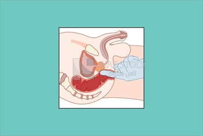 Reproductive system