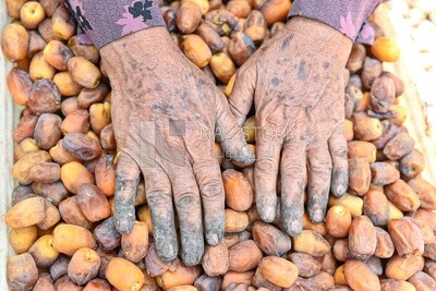 Farmer&#39;s hand affected by work in harvesting dates