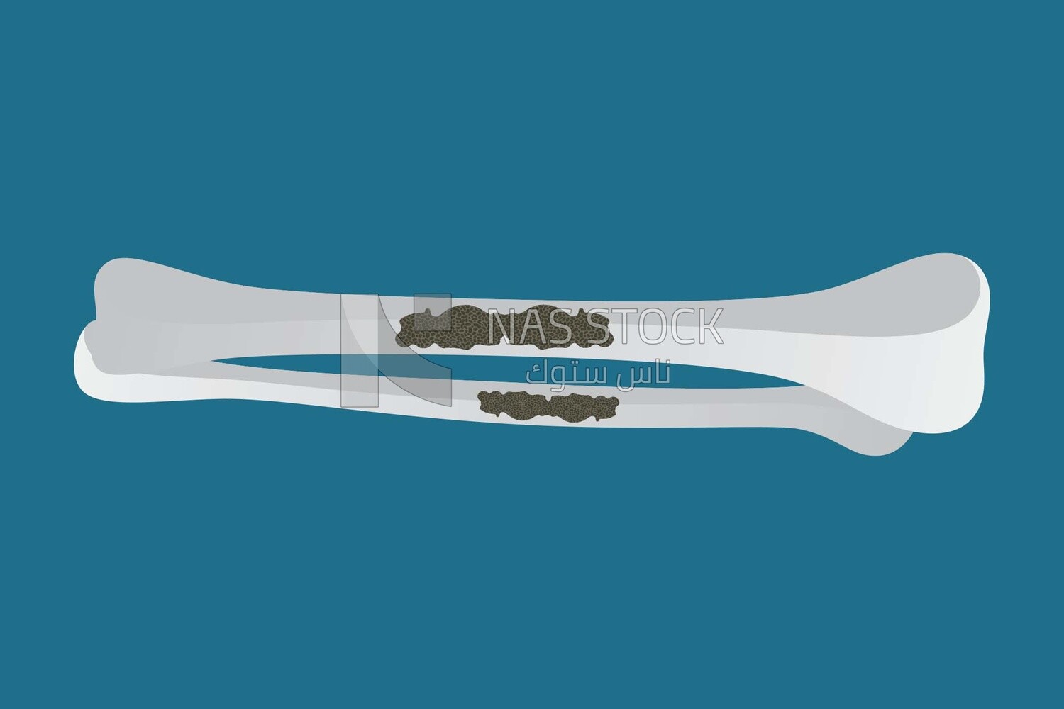 Broken bones, icons and templates, vector illustrator