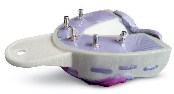 Miratray Implant maxillaire Hager Werken