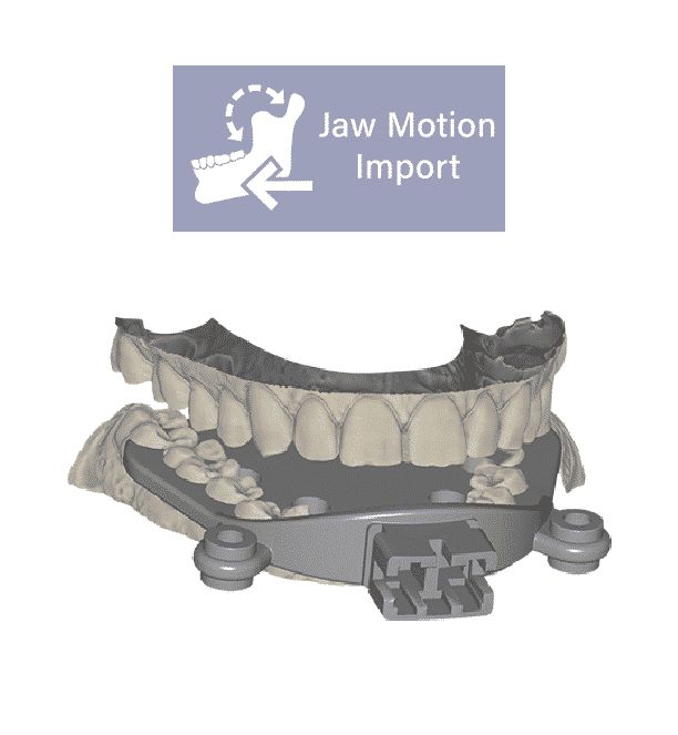 Exocad Add-On (Licence Flex) Module Jaw Motion Import