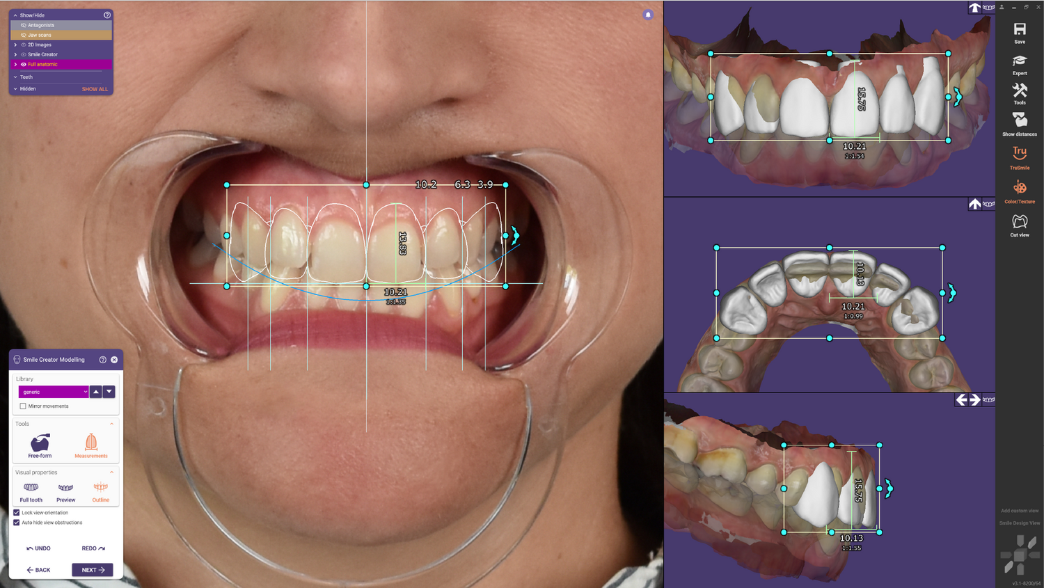 Exocad Add-On (Licence Flex) Module Smile Creator