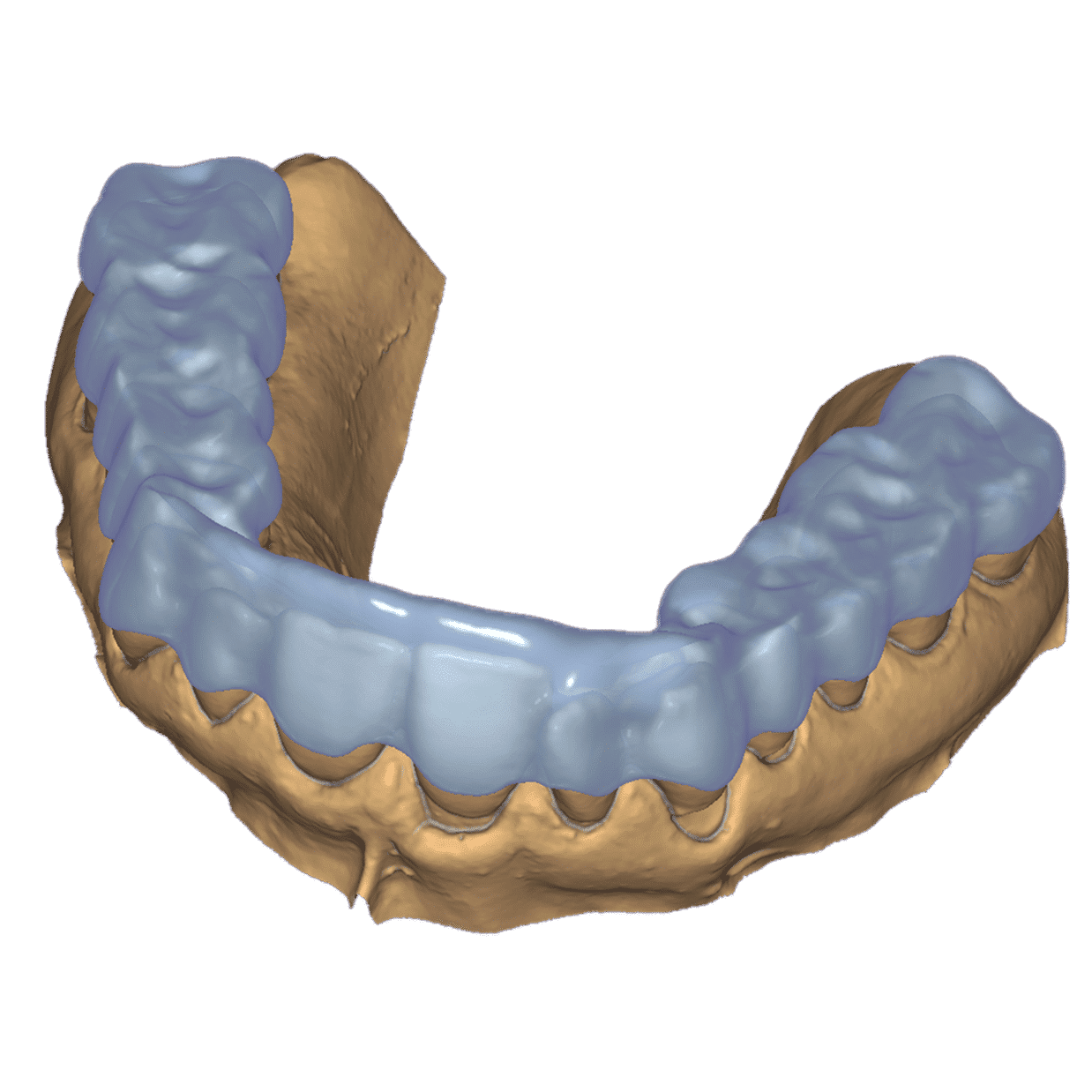 Exocad Add-On (Licence Flex) Module Bite Splint