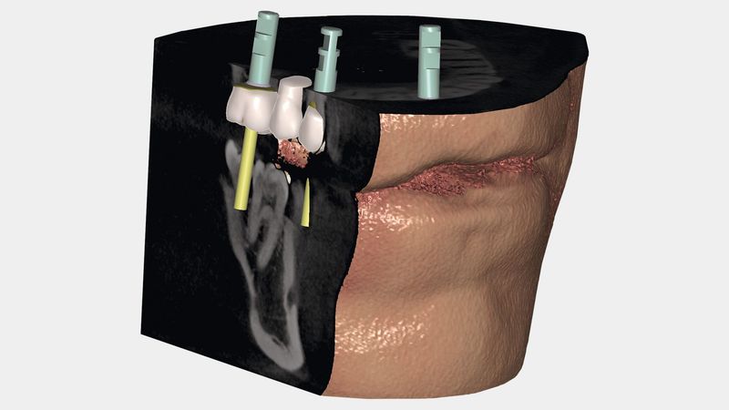 Exocad Add-On (Licence Flex) Module Dicom Viewer