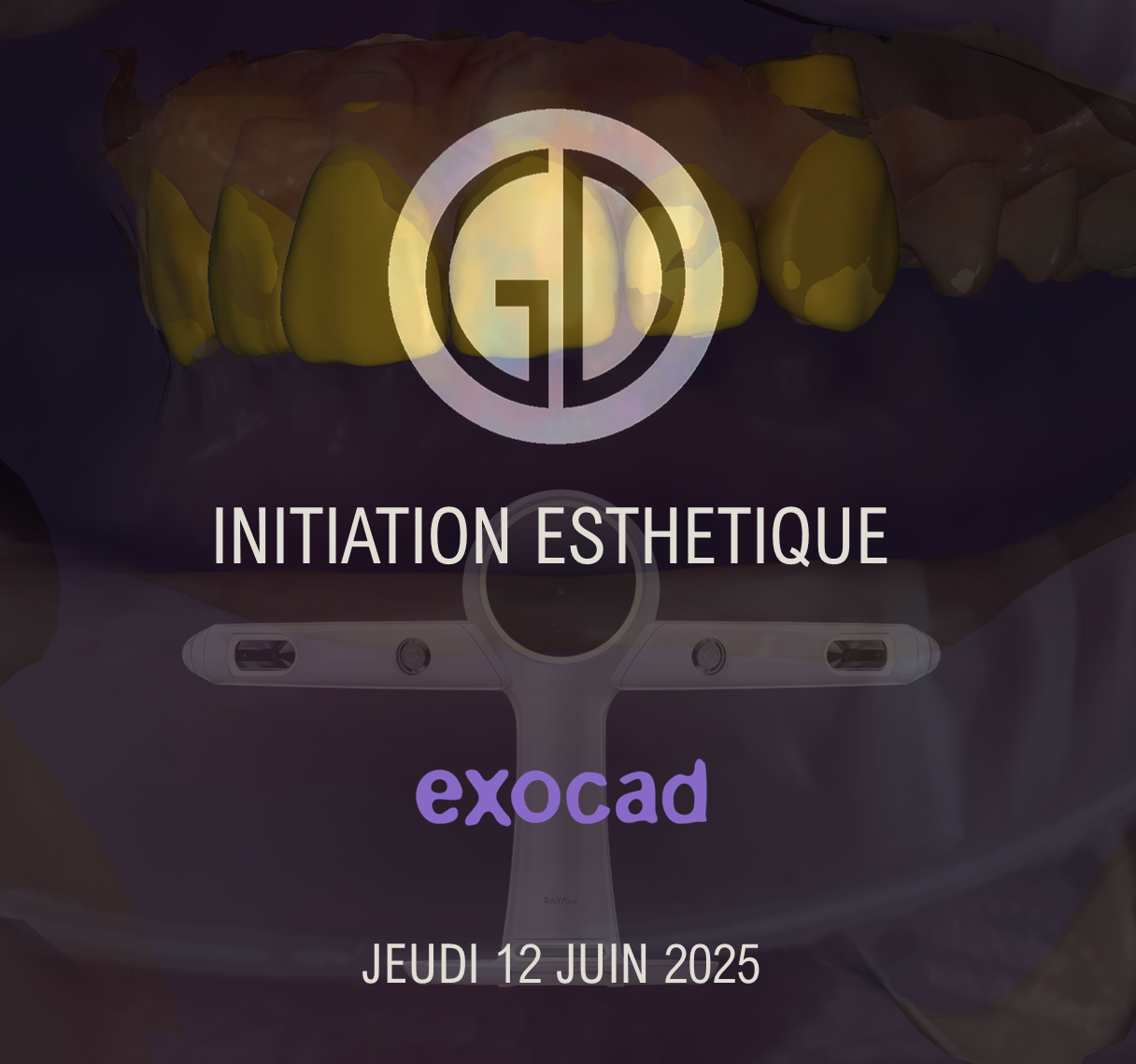 Exocad Smile Creator : Jeudi 12 Juin 2025