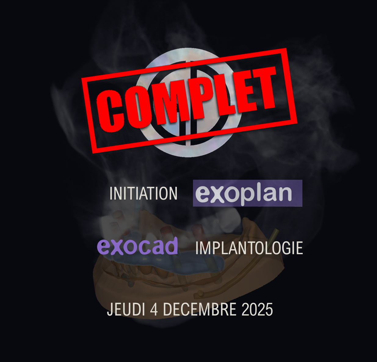 Exoplan / Exocad Implantologie : Jeudi 4 décembre 2025