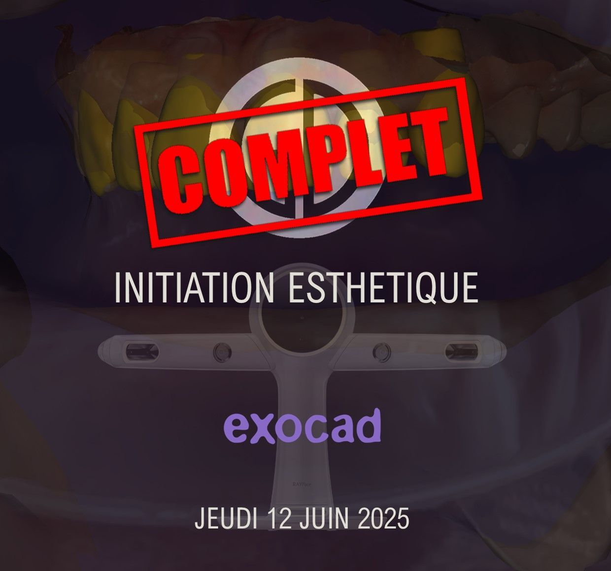 Exocad Smile Creator : Jeudi 12 Juin 2025
