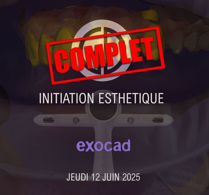 Exocad Smile Creator : Jeudi 12 Juin 2025