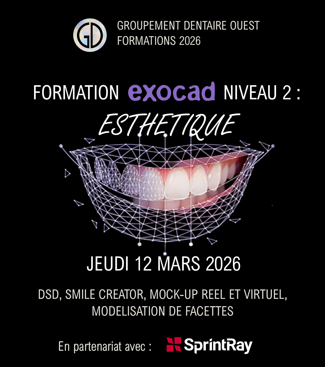 Exocad Smile Creator : Jeudi 12 Mars 2026
