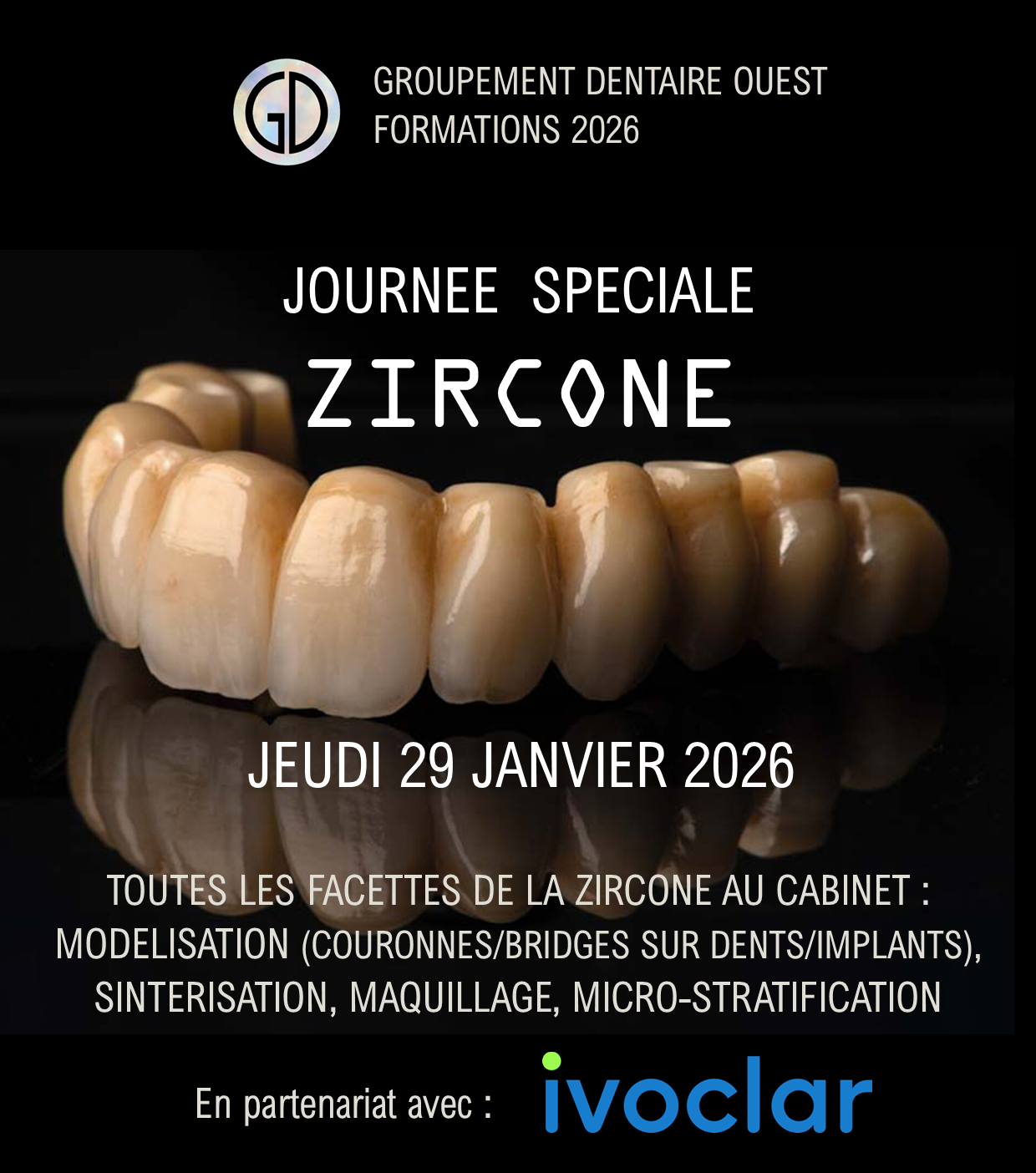 Zircone de A à Z : Jeudi 29 Janvier 2026