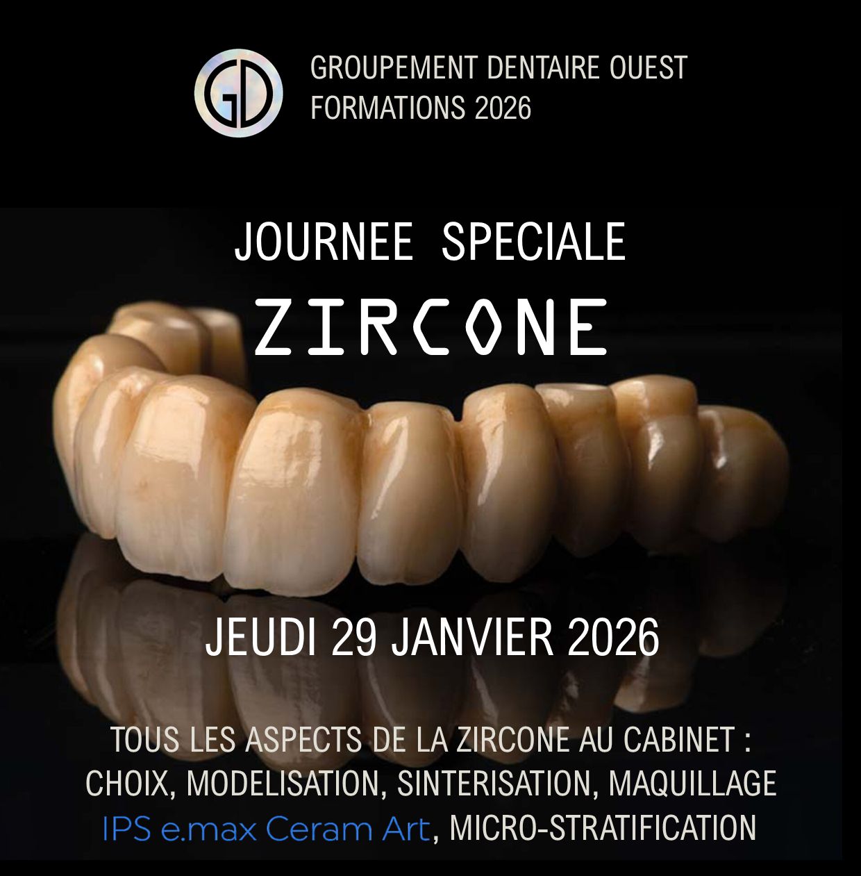 Zircone de A à Z : Jeudi 29 Janvier 2026