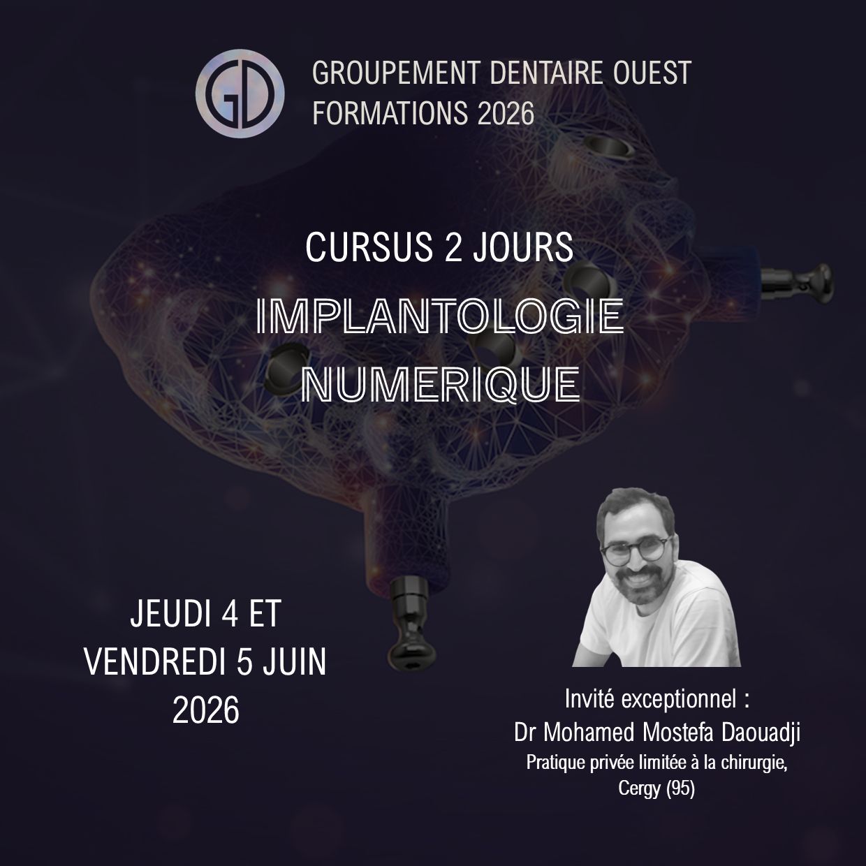 Cursus 2 jours Implantologie Numérique : 4-5 Juin 2026 Cursus 2 jours Implantologie Numérique : 4-5 Juin 2026