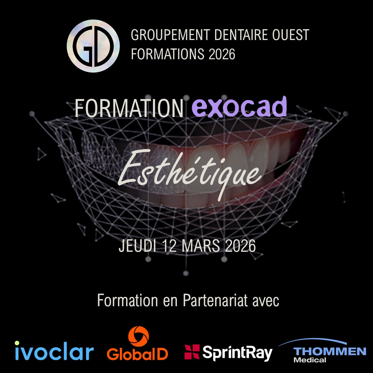 Exocad Smile Creator : Jeudi 12 Mars 2026