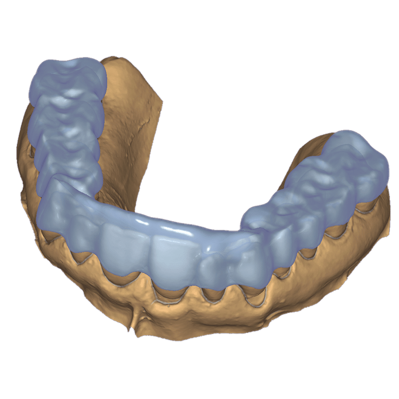 Exocad Add-On (Licence Flex) Module Bite Splint