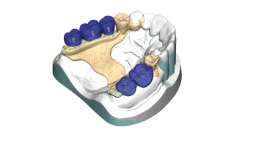 Exocad Add-On (Licence Flex) Module Partial CAD
