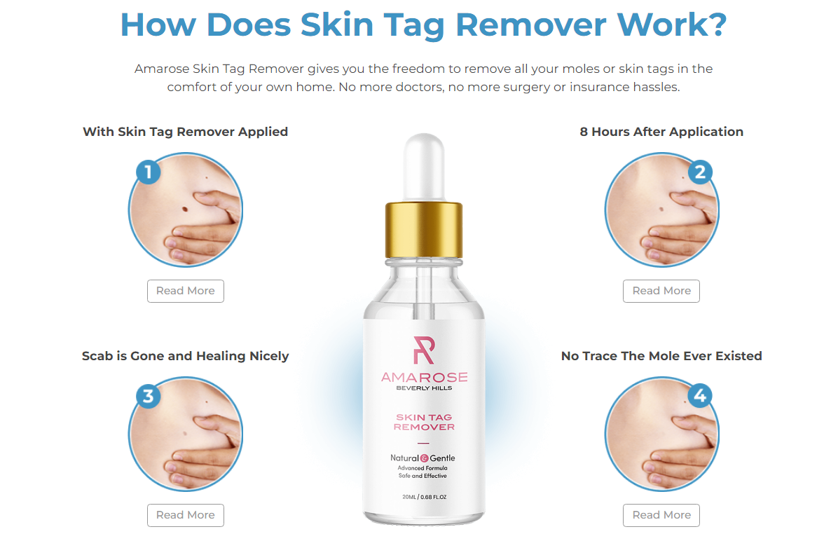 Amarose Skin Tag Remover