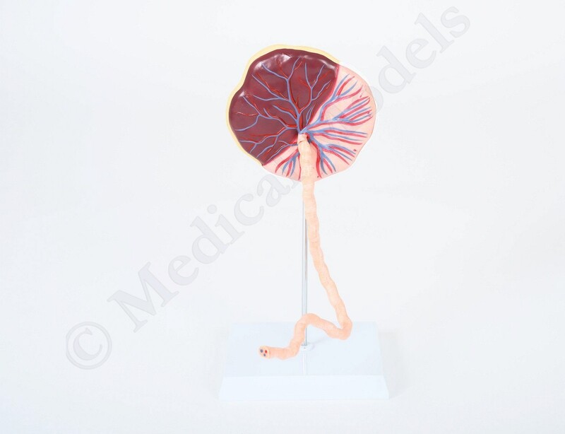 Placenta with Umbilical Cord Model