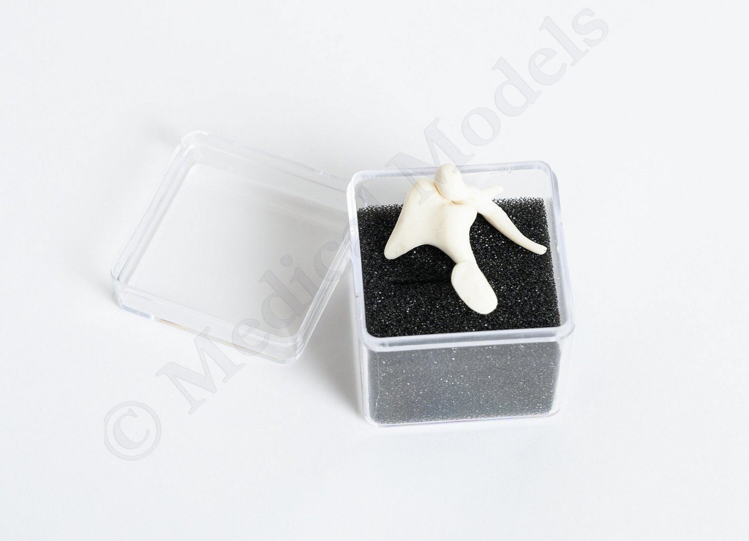 Human Auditory Ossicles Set – Real Bone Display In Acrylic Box (New)