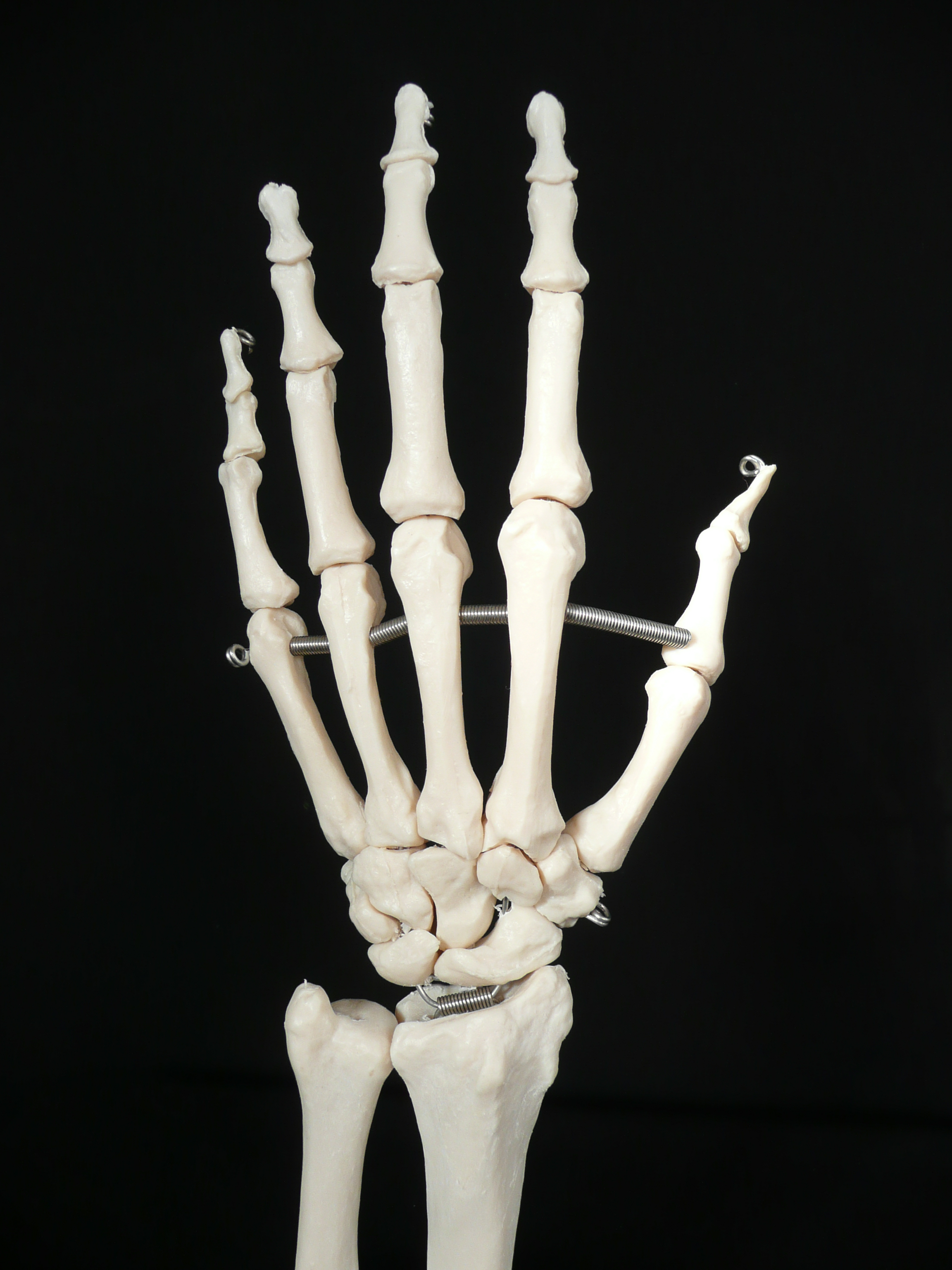 Life-Size Anatomical Human Hand/Wrist Joint Model | Joints – Products