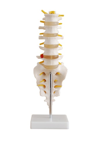 Anatomical Human Life-Size Lumbar Vertebrae with Sacrum &amp; Coccyx and Herniated Disc Model