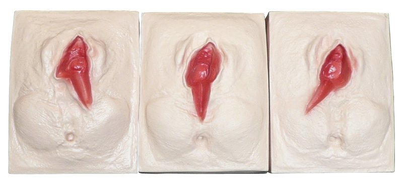 Anatomical Perineal Tear Repair Model - Perineum Vaginal Laceration Suture Training