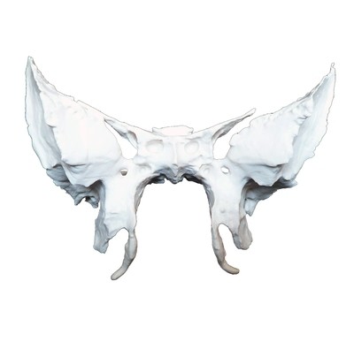 Anatomical Human Sphenoid Bone Model