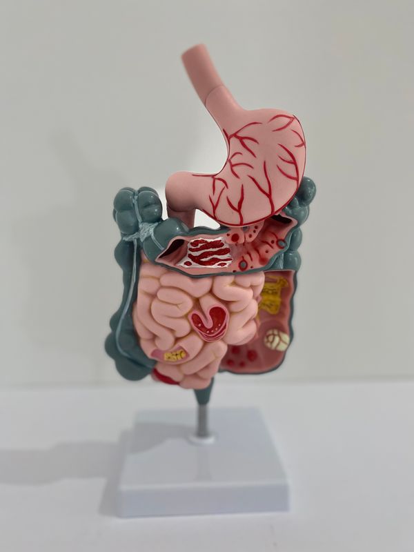 Anatomical Human Diseased Digestive System