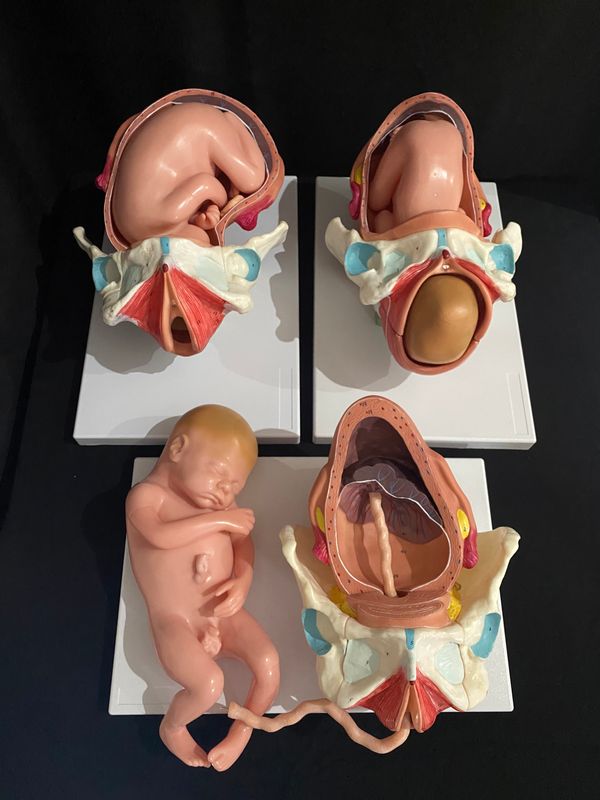 Set of Birthing Models