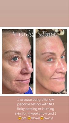 Retinol Peptide- Truface