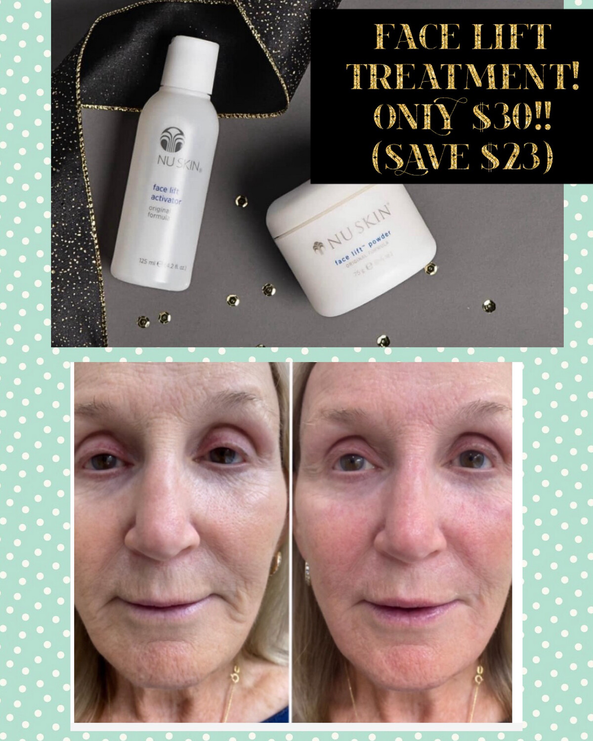 Face LIFT Treatment