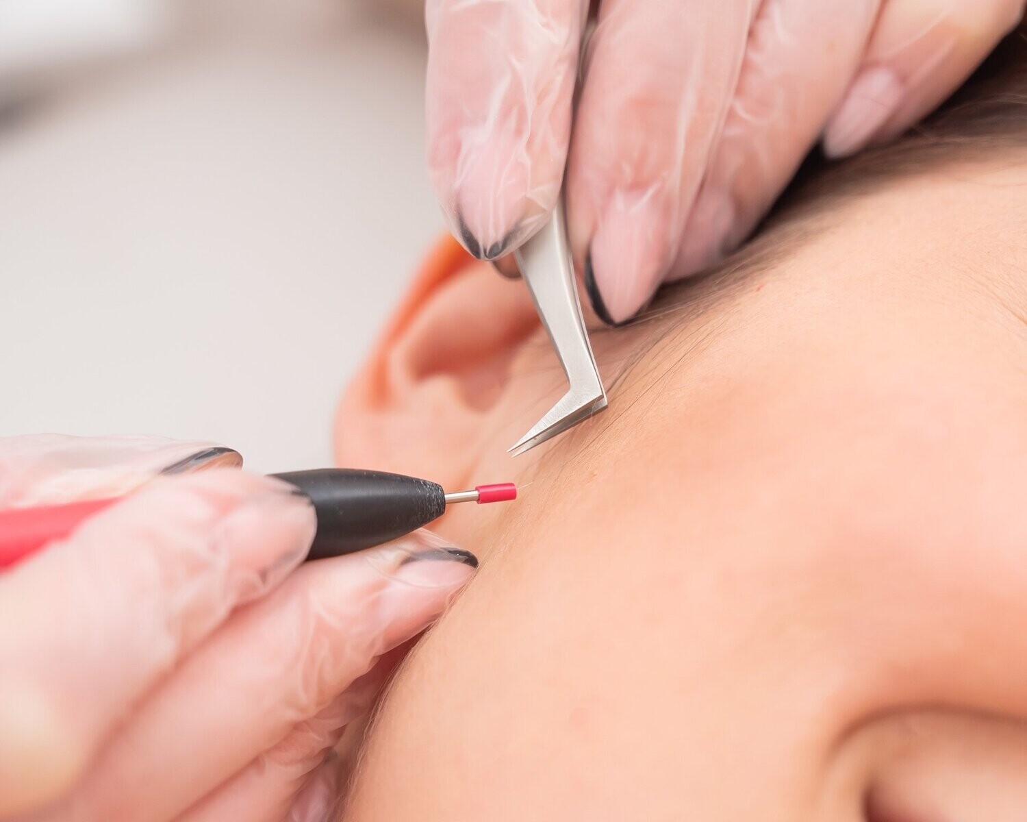 What is Electrolysis?