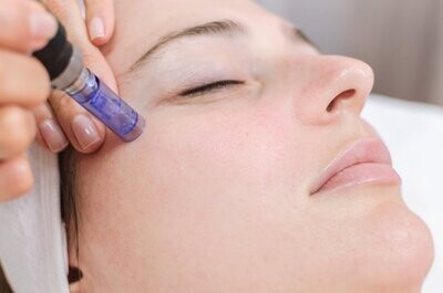 Microneedling - Collagen Induction Therapy