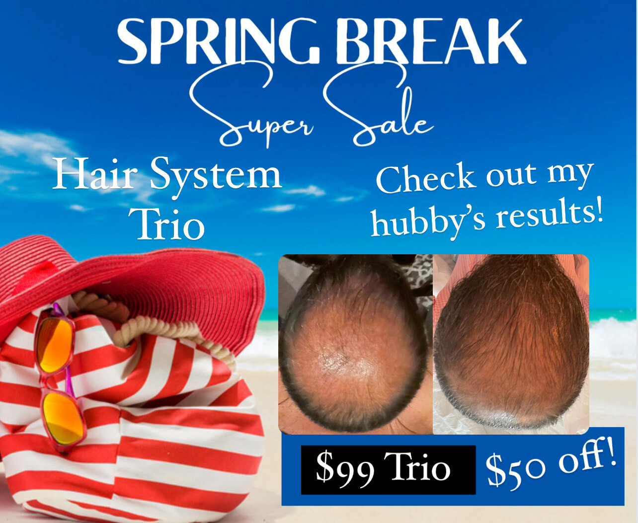 Trio Hair System