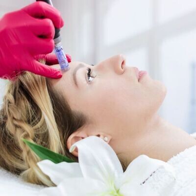 Microneedling